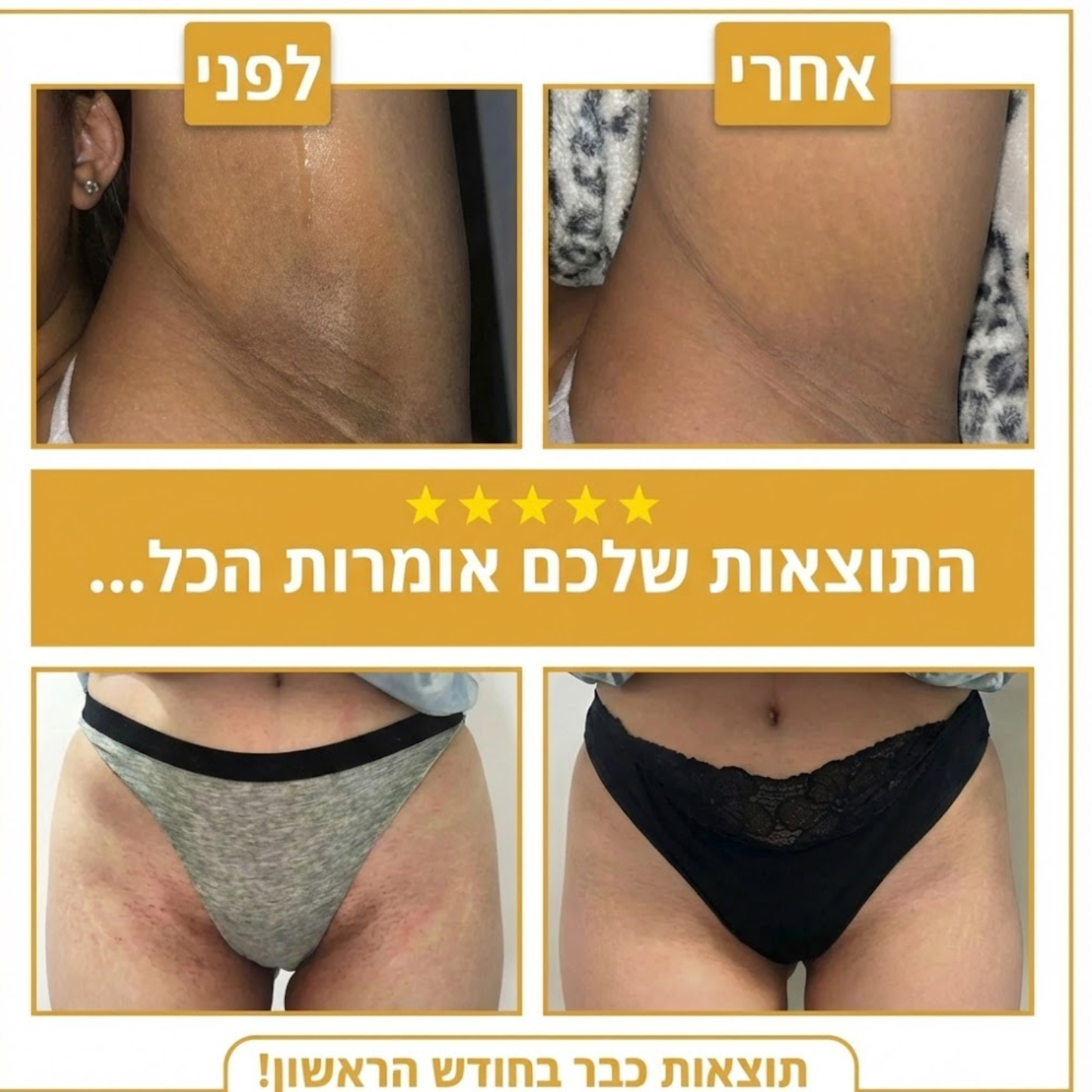 סבון ההבהרה של Lamura